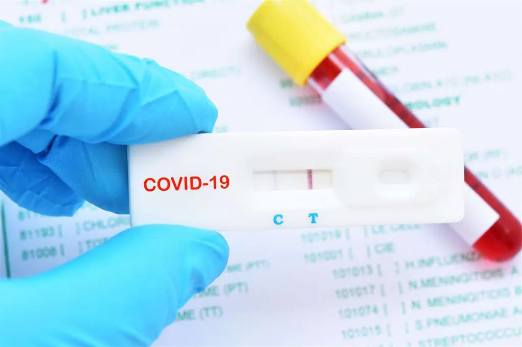 Covid-Test-Results